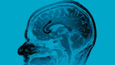 دماغك تحت تأثير الإباحية